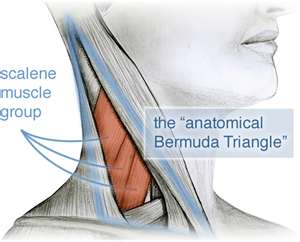 The tensor fascia lata (TFL) is - NeuroKinetic Therapy